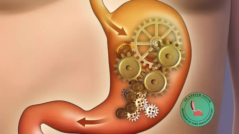 أعراض كسل المعدة