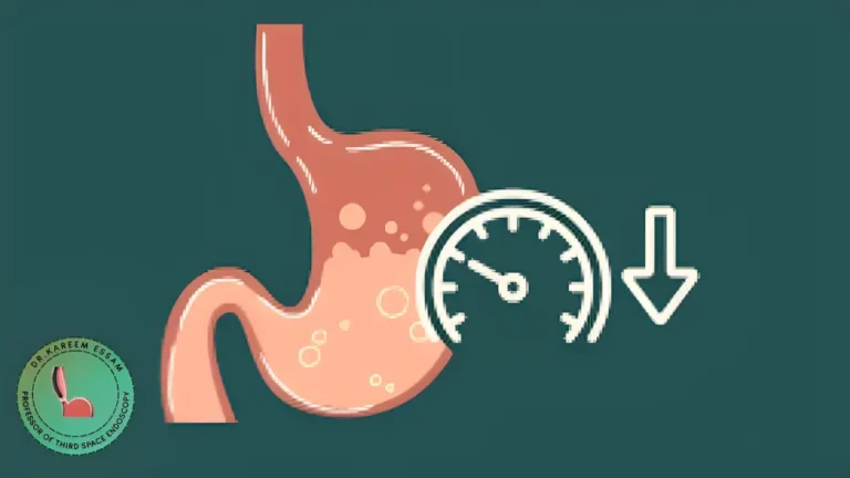 تجربتي مع خزل المعدة