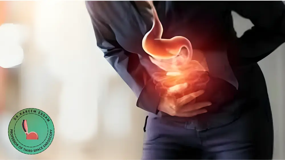 عملية ارتجاع المريء بالمنظار 