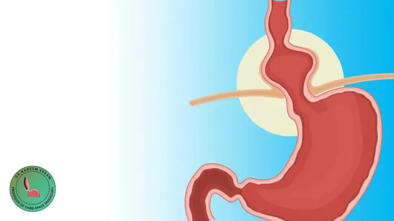 أعراض فتق الحجاب الحاجز