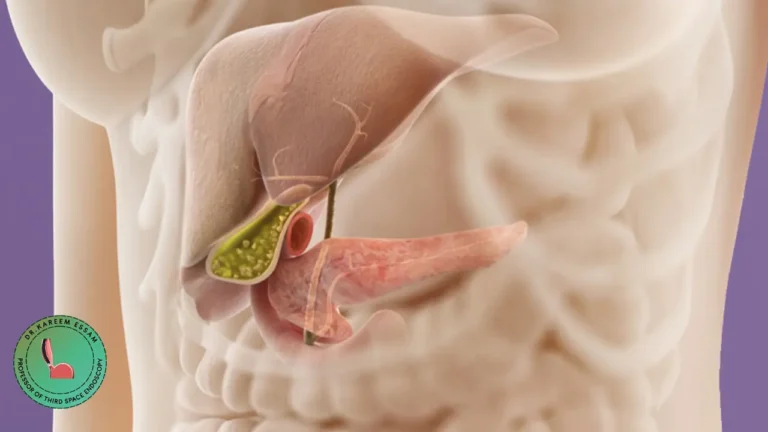 أعراض انسداد القناة المرارية