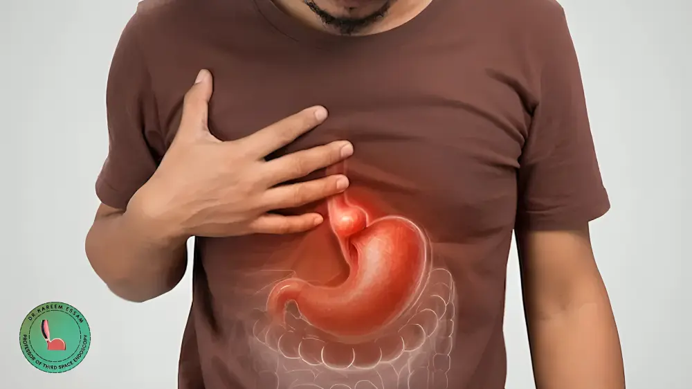 تجربتي مع عملية فتق الحجاب الحاجز