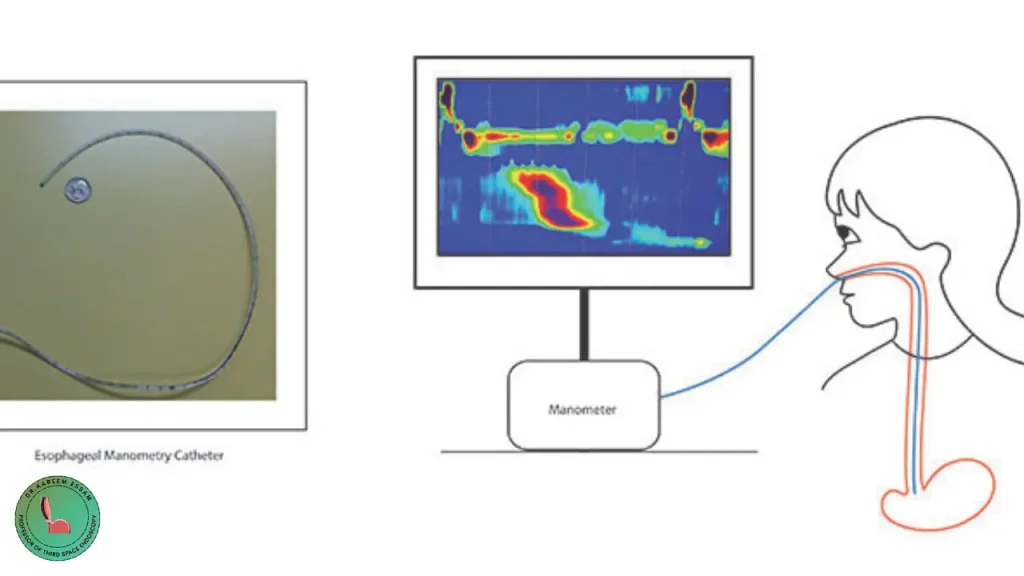 اختبار حركية المريء