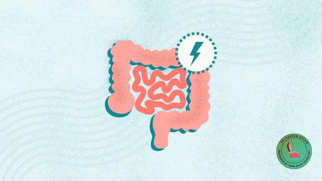 علاج كسل الأمعاء