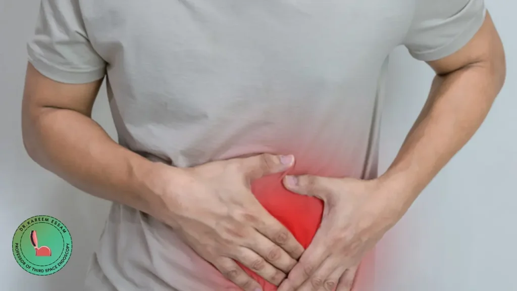 علاج ورم المعدة الحميد